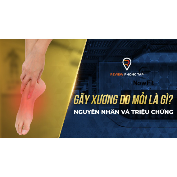 Nguyên Nhân Gãy Xương Do Mỏi Là Gì?