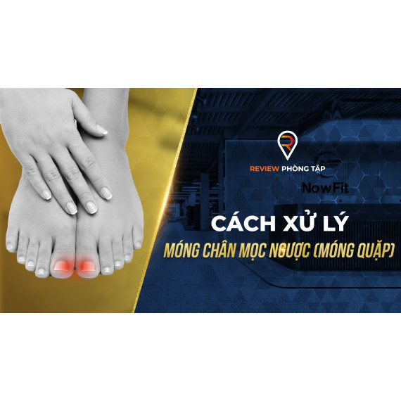 Cách Xử Lý Móng Chân Mọc Ngược (Móng Quặp)